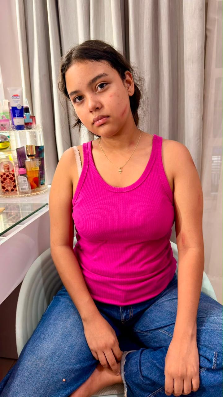 Sara sentada, con raspones en la cara